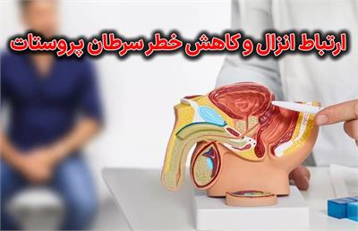 ارتباط انزال و کاهش خطر سرطان پروستات