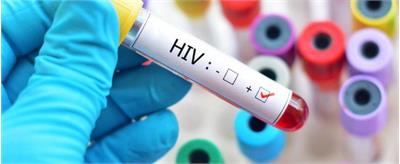 شناسایی بیش از ۲۴۰۰۰ بیمار HIV در ایران